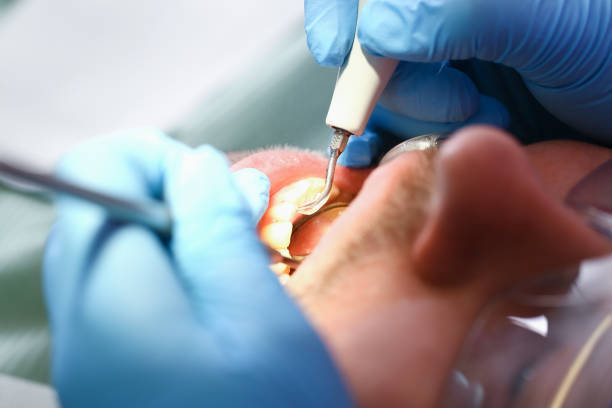 Best Urgent Dental Care for Toothaches in Collinsville, TX